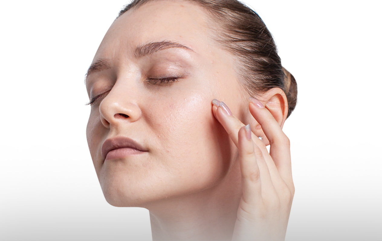 Before Pure Peel skincare – girl with dull skin texture