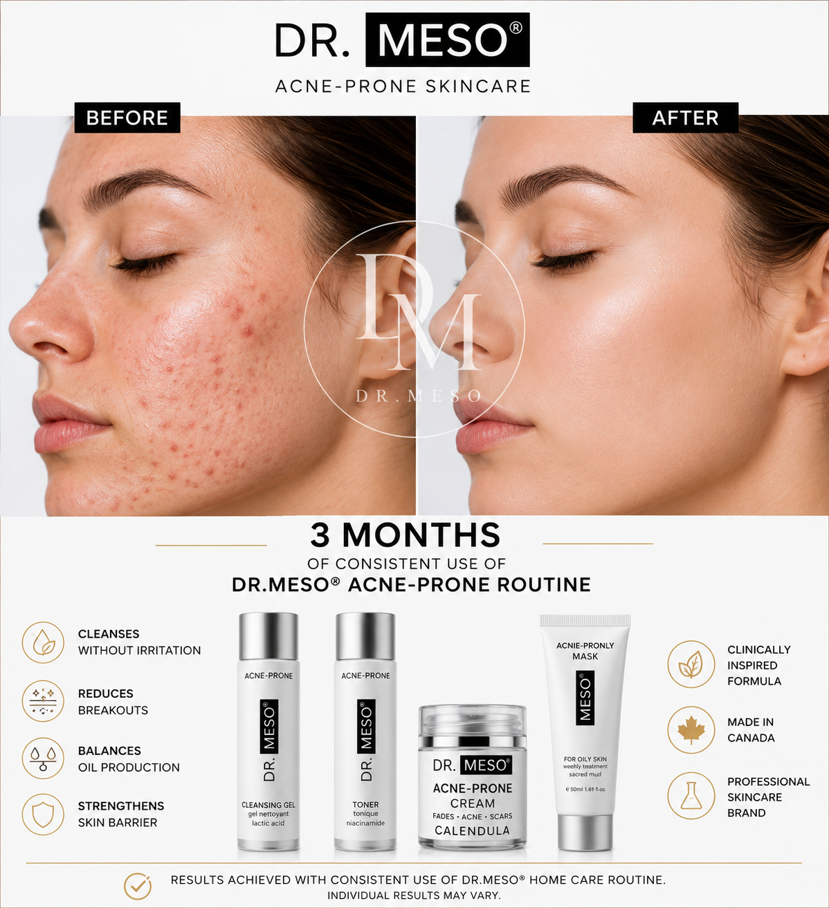 Training DR.MESO Acne Treatment Program