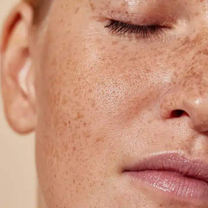 Close-up of a person's face with freckles on a beige background