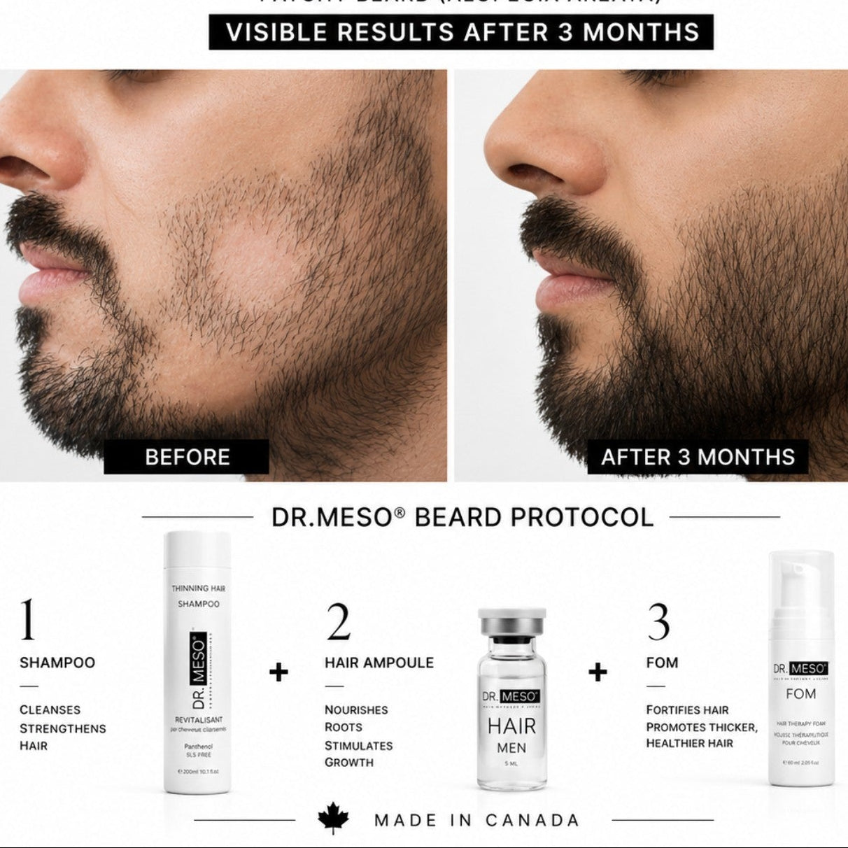Hair Peptide Serum for Thinning Hair | DR.MESO® Scalp Care Canada