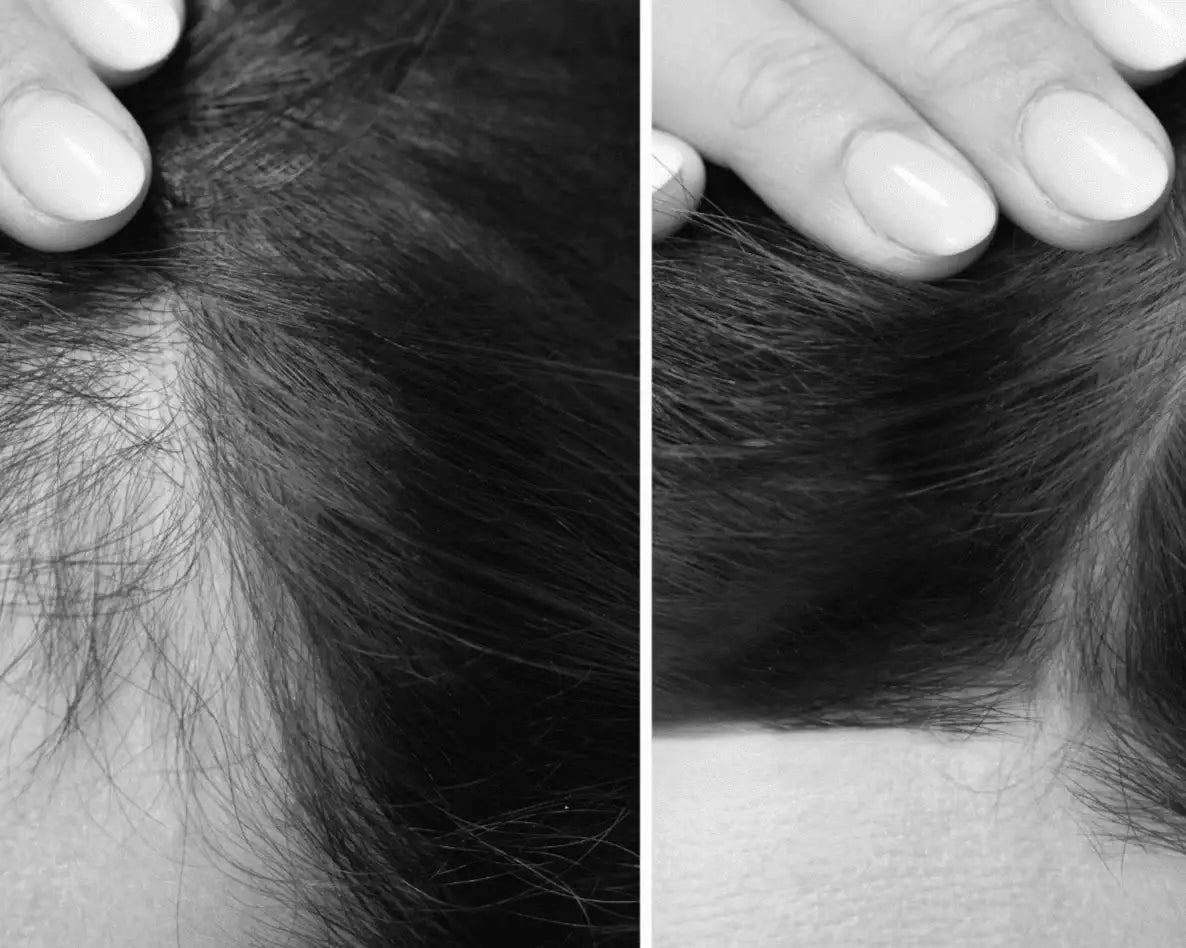 SCALP & HAIR REVITALIZING MASK