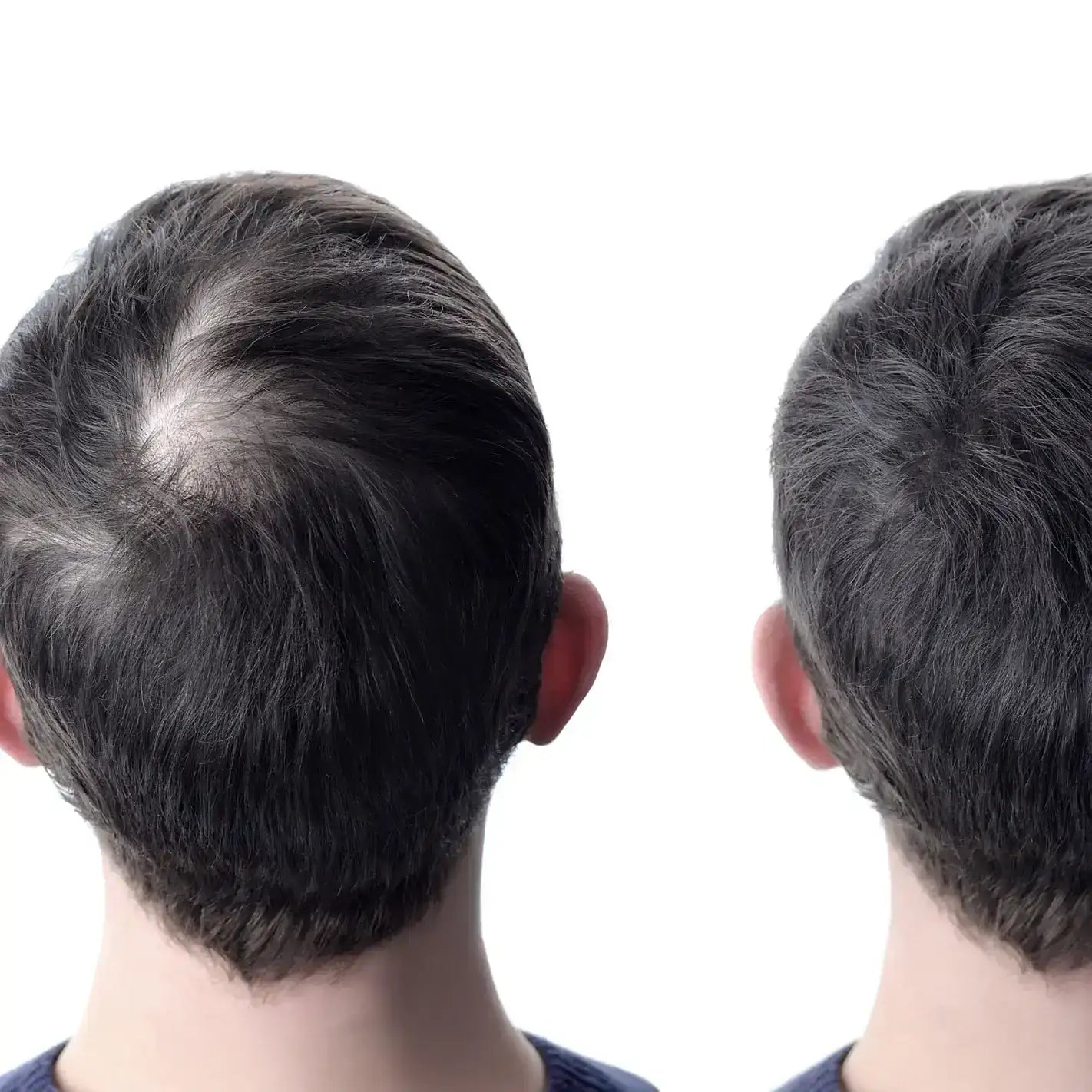 THINNING HAIR CONDITIONER